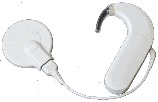 Cochlear Implant-external component