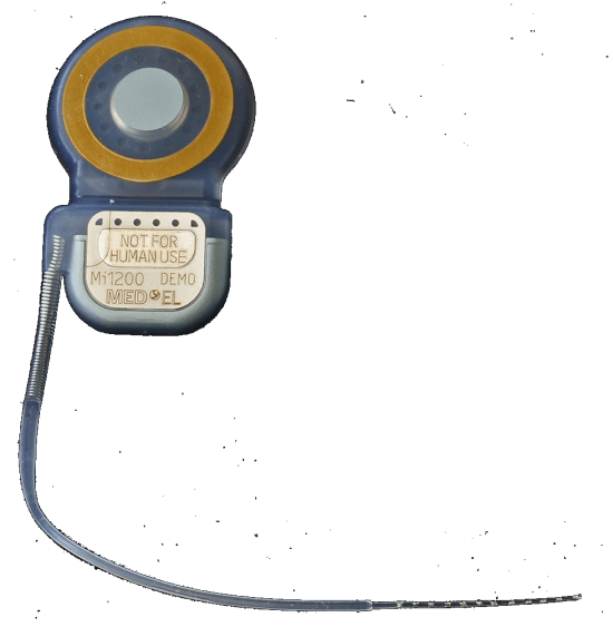Cochlear Implant-internal component